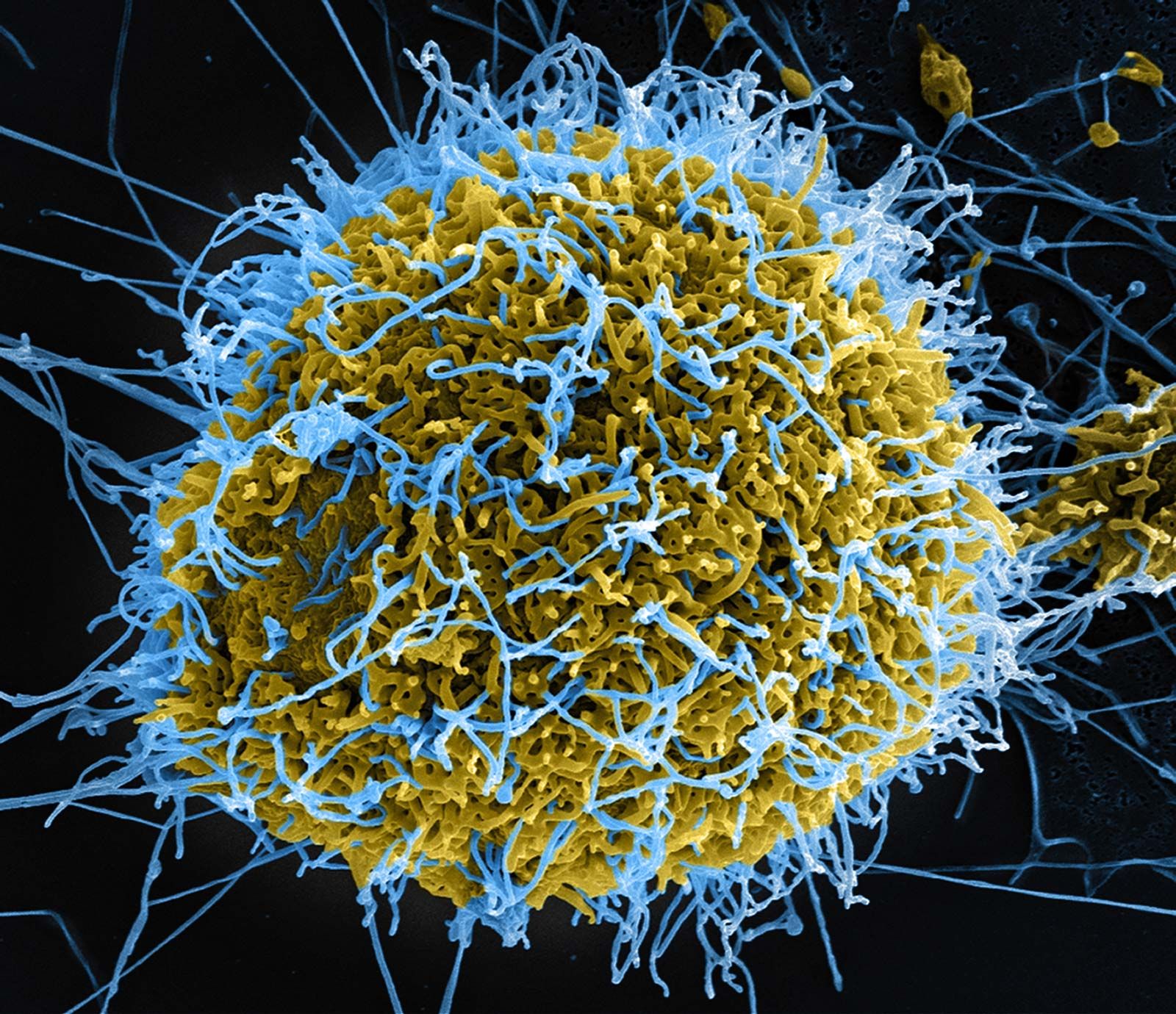 Pandemia de Ebola em 2026?